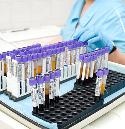 Laboratory testing